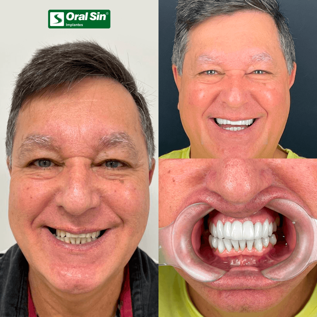Sorriso reconquistado